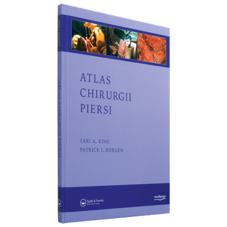 Atlas chirurgii piersi