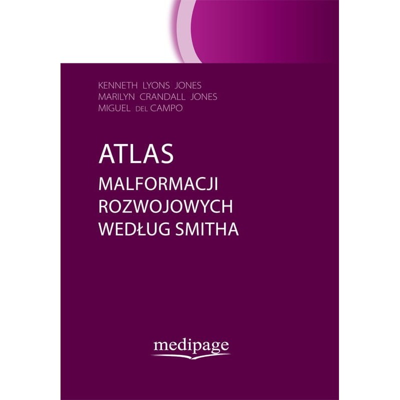 Atlas malformacji rozwojowych według Smitha