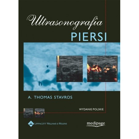 Ultrasonografia piersi. Stavros