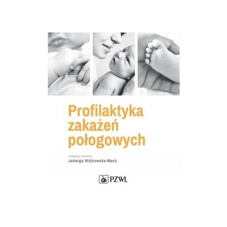 Profilaktyka zakażeń połogowych