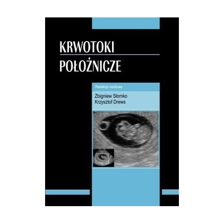 Krwotoki położnicze