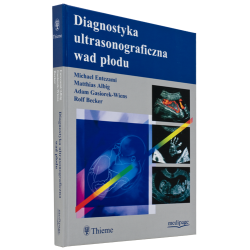 Diagnostyka ultrasonograficzna wad płodu