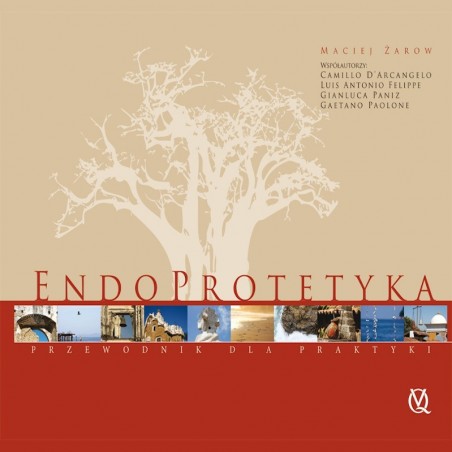 Endoprotetyka