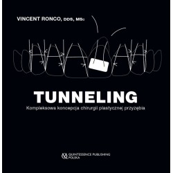 TUNNELING Kompleksowa koncepcja chirurgii plastycznej przyzębia