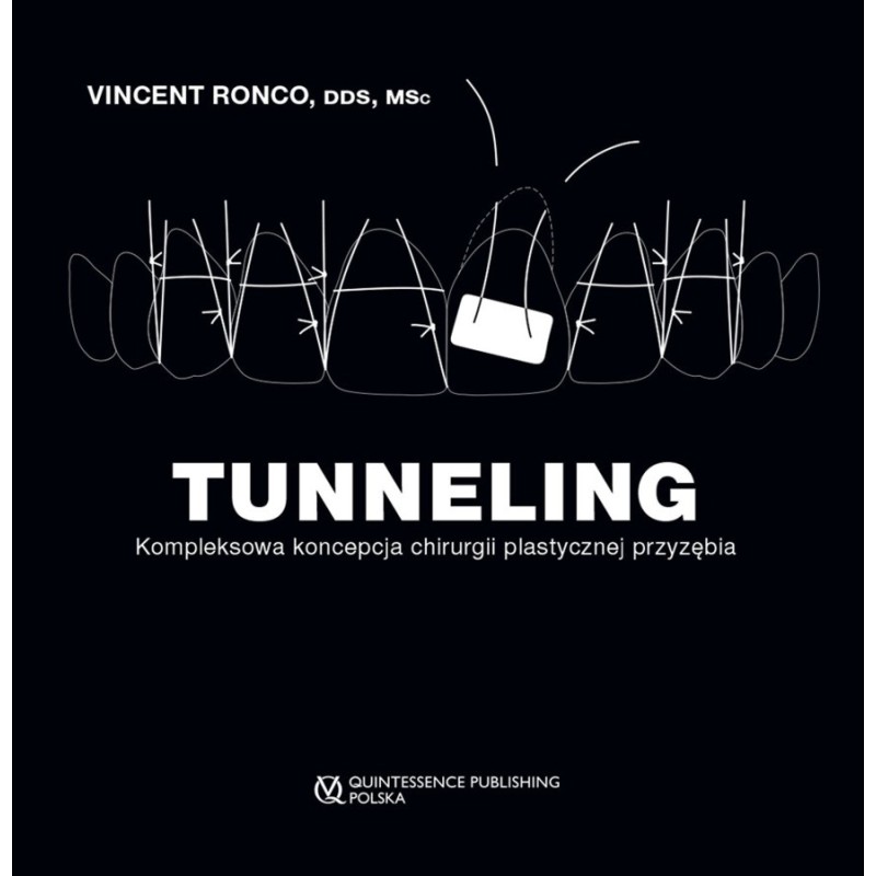 TUNNELING Kompleksowa koncepcja chirurgii plastycznej przyzębia