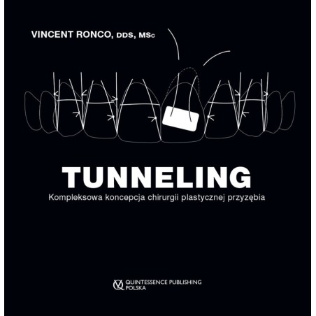 TUNNELING Kompleksowa koncepcja chirurgii plastycznej przyzębia